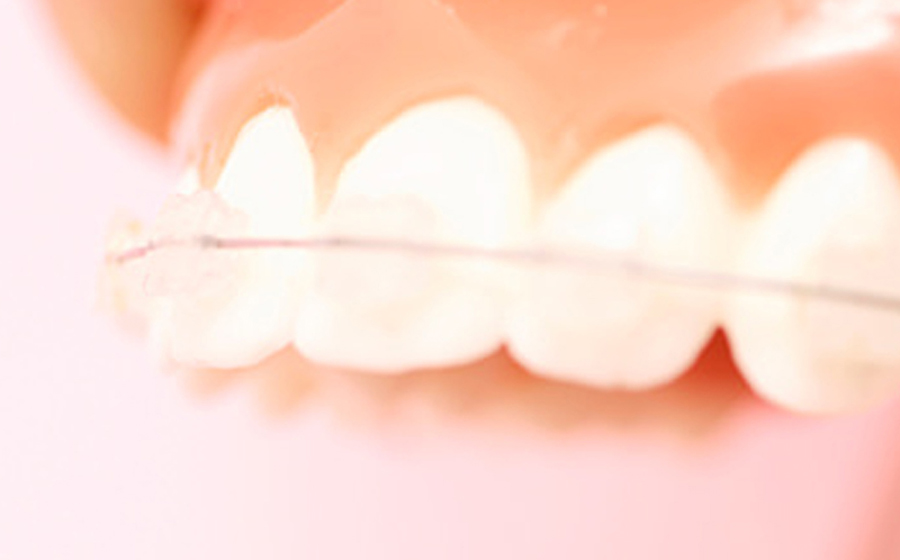 立川の矯正歯科、まろ歯科クリニックの矯正治療