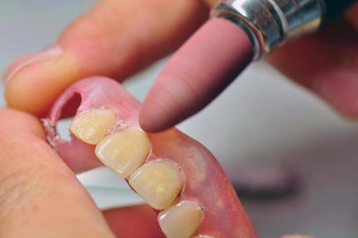 立川の歯医者、まろ歯科クリニックの入れ歯治療