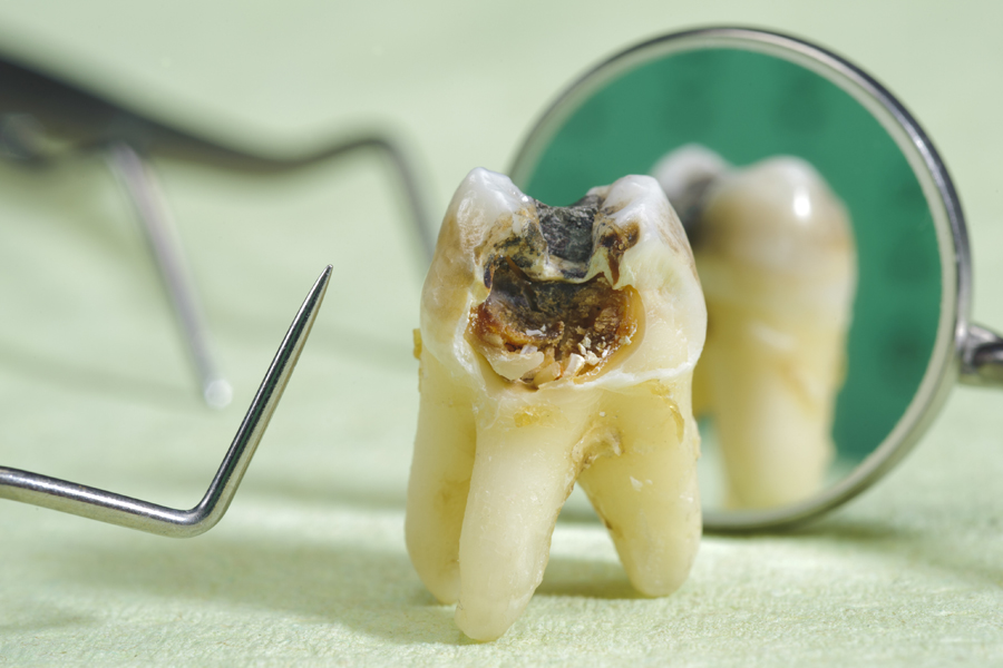 立川の歯医者、まろ歯科クリニックの口臭治療